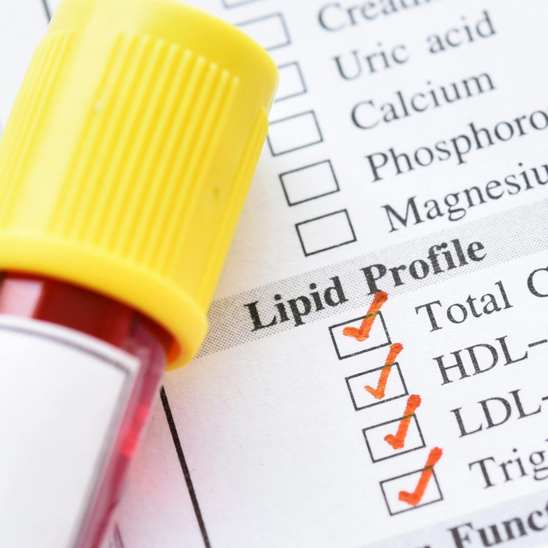 lipidogram