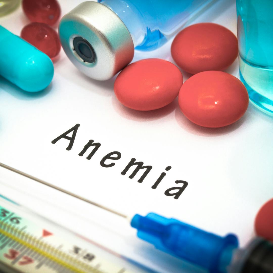 anemia